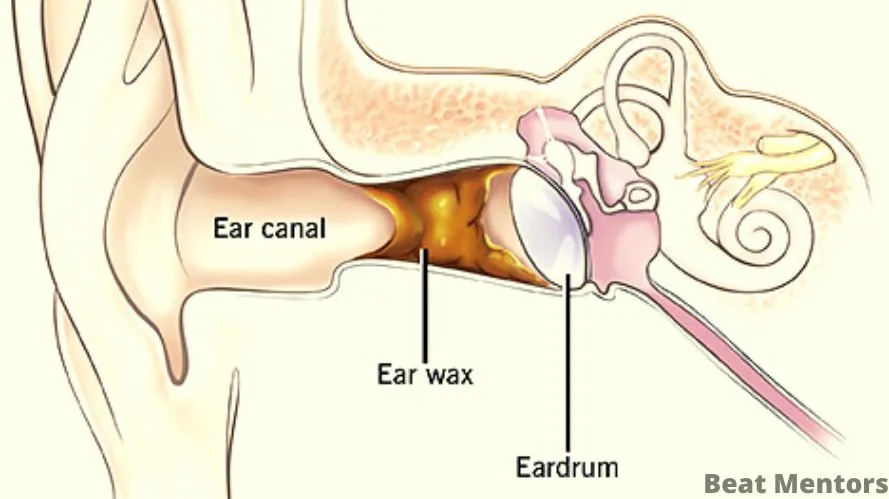 Ear Wax inside the ear canal
