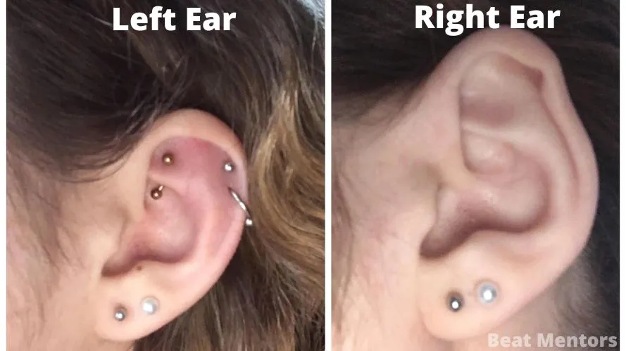 Right Ear vs Left Ear